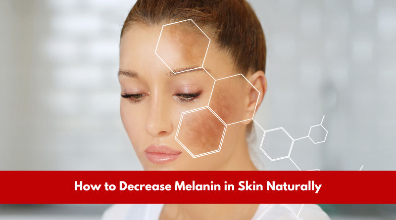 How to Decrease Melanin in Skin Naturally