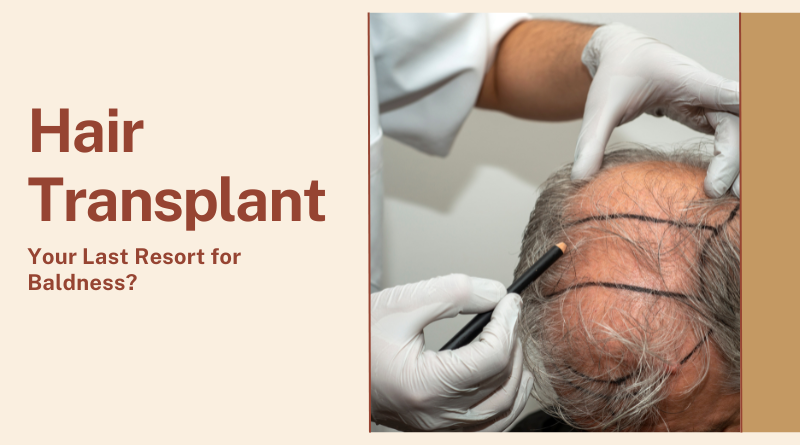 Hair Transplant