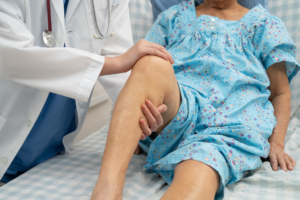 knee replacement surgery in delhi