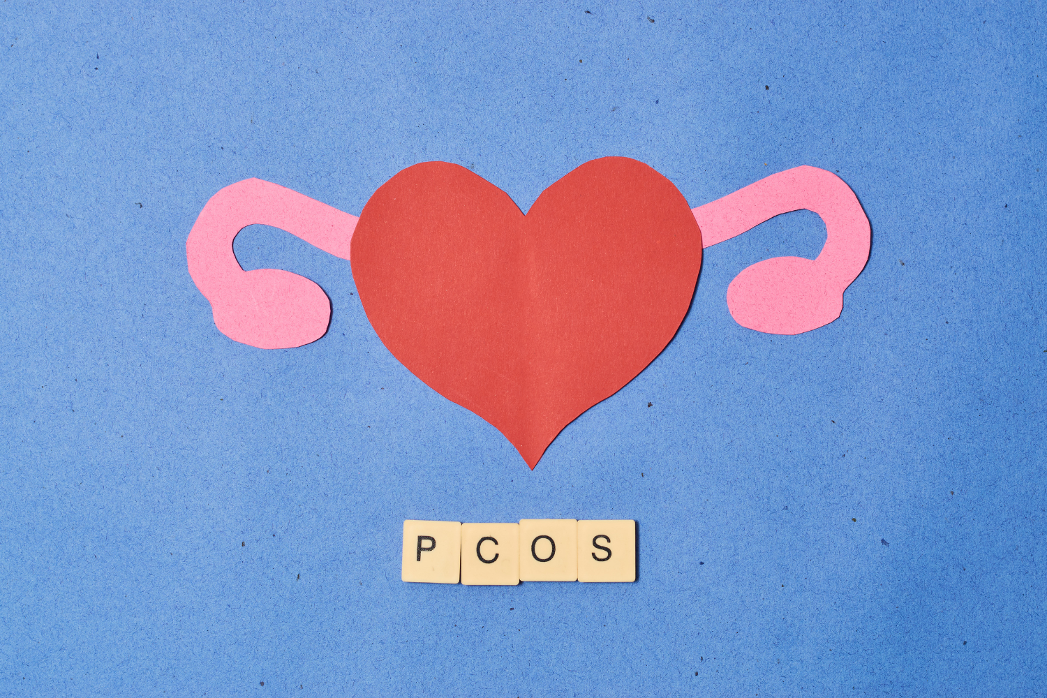 pcos