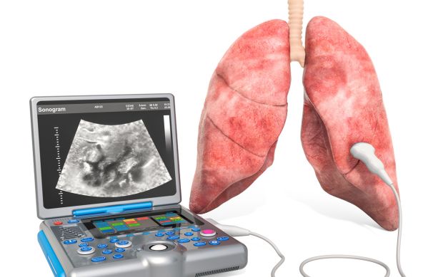 pollution and lungs health (2)